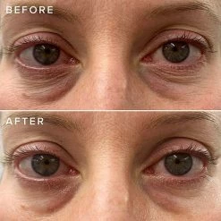 Hot Sale 👍 Farmacy Cheer Up Brightening Vitamin C Eye Cream With Acerola Cherry 🔥 -Beauty Shop unnamed file 900